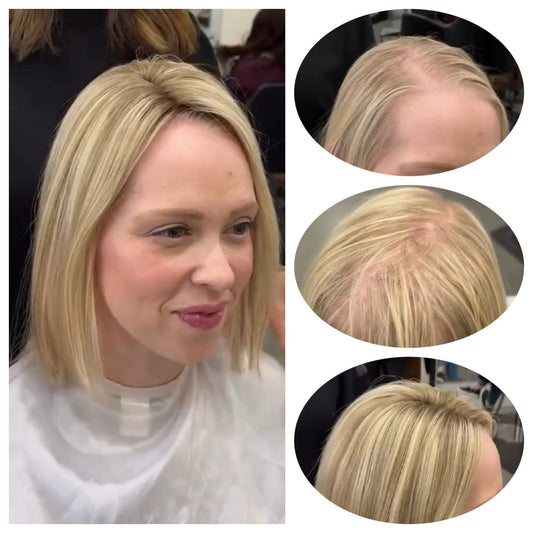 Best Hair Toppers for Thinning Hair and Hair Loss Women