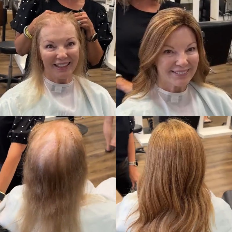 Hot Sale Natural Wave Hair Topper for Thinning Hair - Ultra Comfort Wear