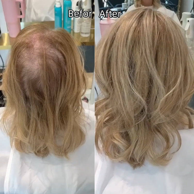 Premium Wavy Hair Topper for Thinning Hair – Natural Looking Voluminous Human Hair