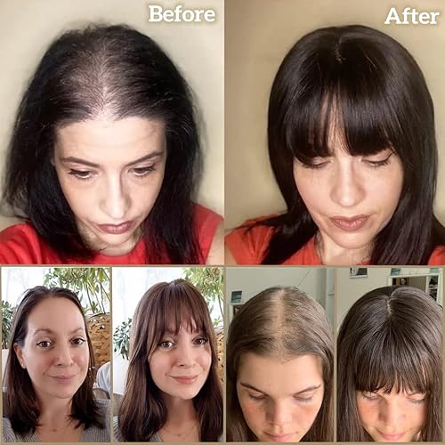 Summer Breathable Straight Hair Topper With Bangs For Thinning Hair