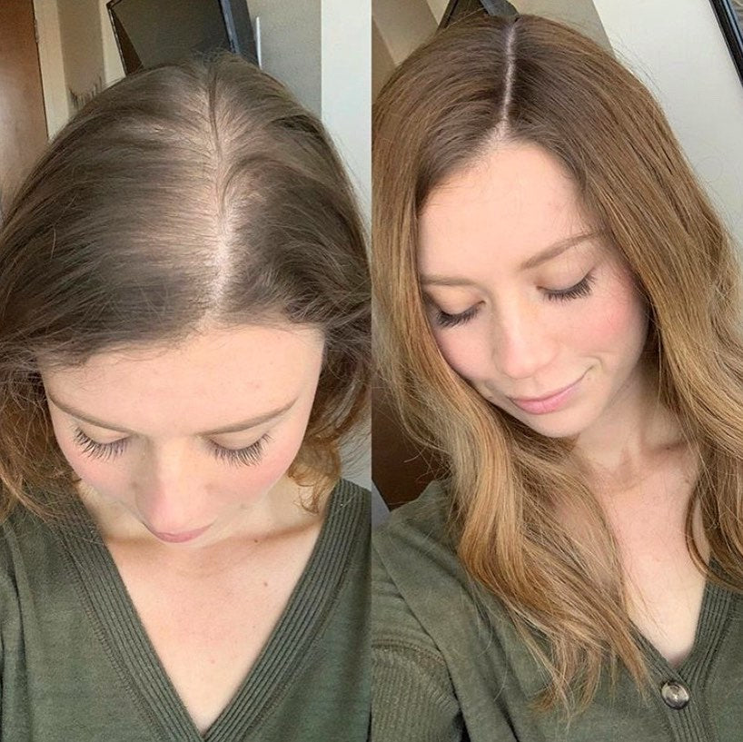 Hot Sale Natural Wave Hair Topper for Thinning Hair - Ultra Comfort Wear