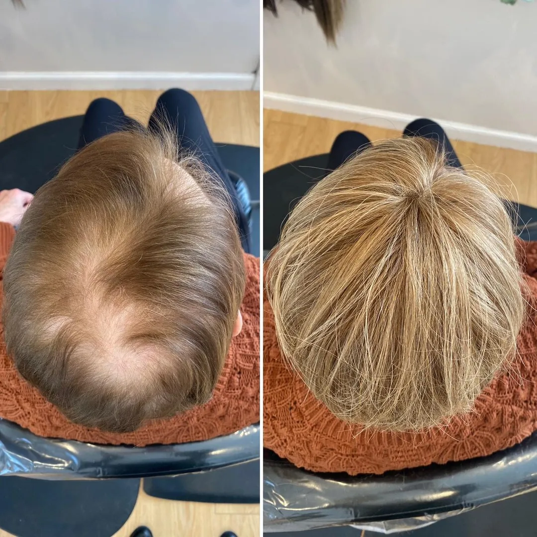 2025 Upgrade Version Short Wiglets Hair Pieces for Women with Thinning and Fine Hair