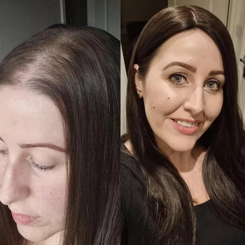Premium Straight Hair Topper For Women With Thinning Hair-Add Instant Volume And Coverage