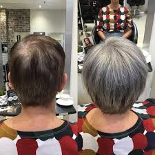 Premium Short Hair Topper for Thinning Hair – Instant Volume Boost
