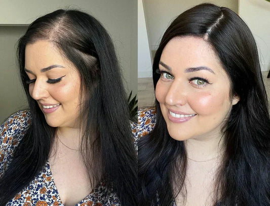 How to Choose the Right Human Hair Topper