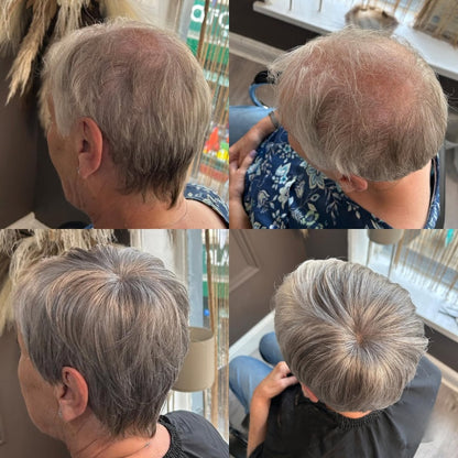 Best-Selling Pixie Cut Hair Topper — Perfect for Thinning Hair!