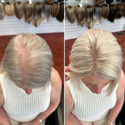 Natural Hair Topper – Seamless Crown Coverage for Thinning Hair & Instant Volume Booster