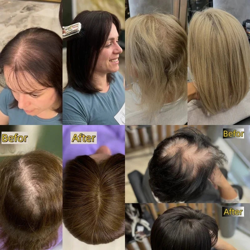 Natural Hair Topper – Seamless Crown Coverage for Thinning Hair & Instant Volume Booster