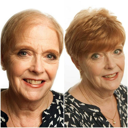 Summer Breathable&comfortable Short Hair Topper For Thinning Hair