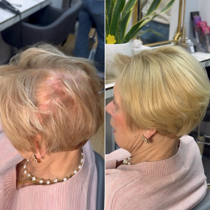 Best-Selling Pixie Cut Hair Topper — Perfect for Thinning Hair!