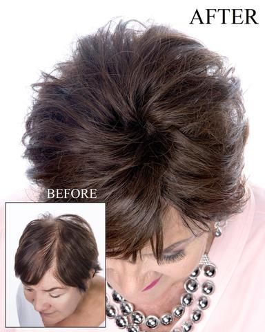 2025 New Summer Breathable&comfortable Short Hair Topper For Thinning Hair