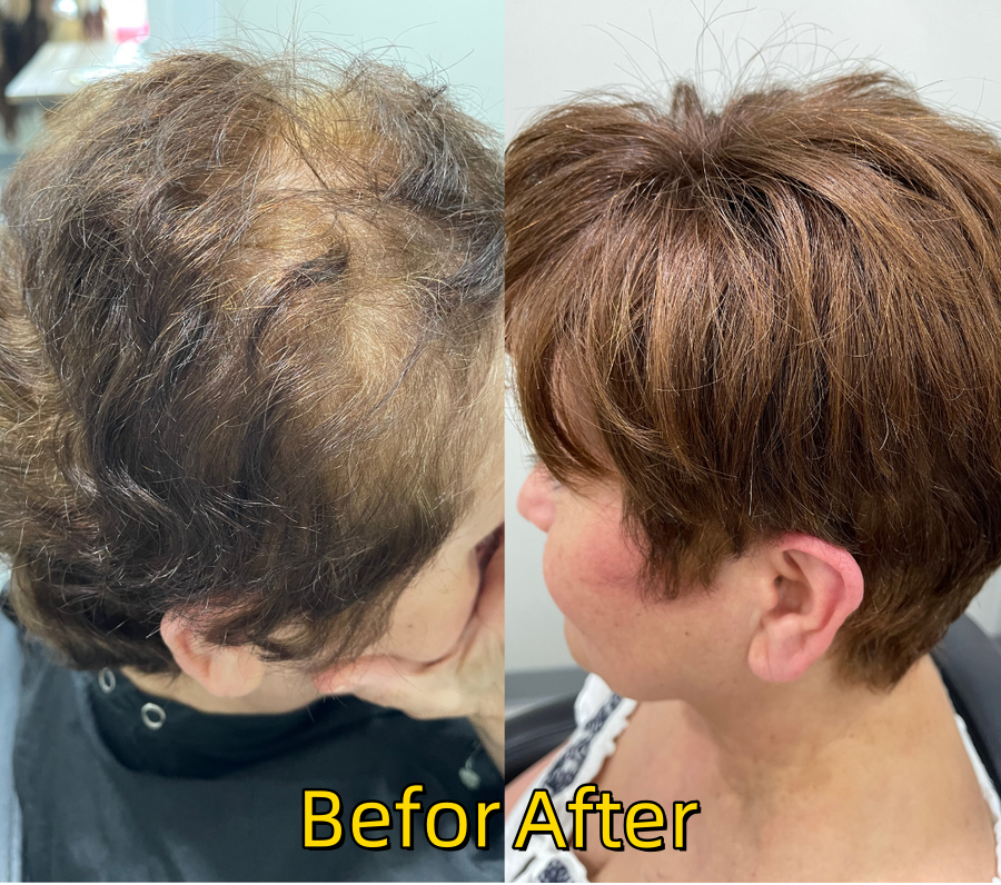 Summer Breathable Short Hair Topper for Thinning Hair