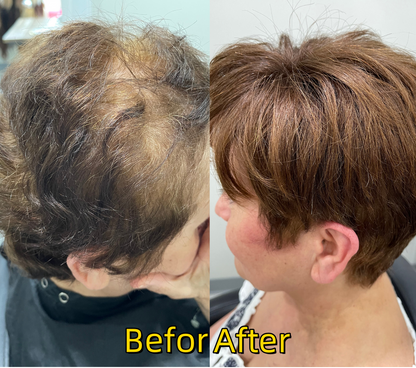 Summer Breathable Short Hair Topper for Thinning Hair