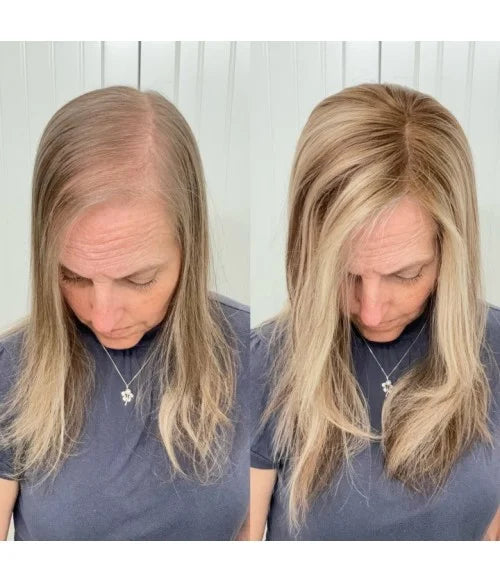 2025 New Lightweight&Breathable Straight Hair Topper For Women With Thinning Hair