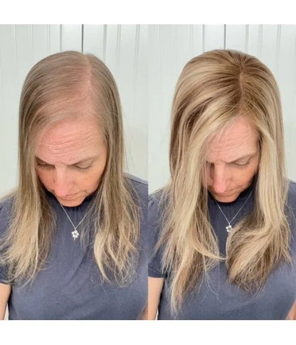 2025 New Lightweight&Breathable Straight Hair Topper For Women With Thinning Hair
