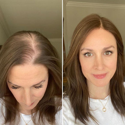 Premium Straight Hair Topper For Women With Thinning Hair-Add Instant Volume And Coverage