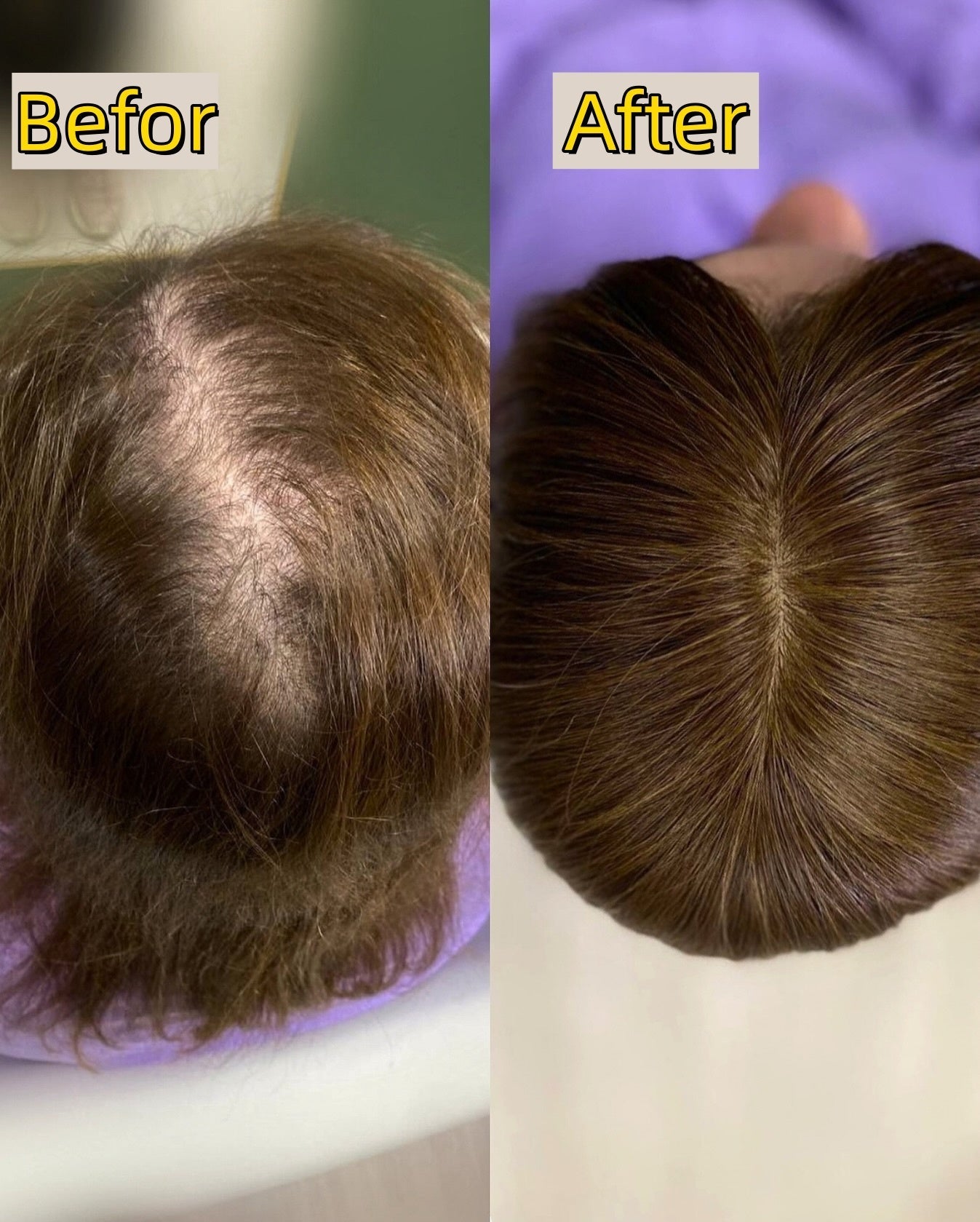 Seamless Hair Topper for Instant Fullness - Everyday Volume & Confidence