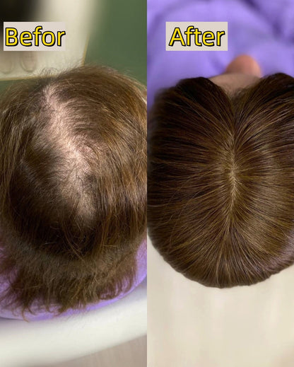 Seamless Hair Topper for Instant Fullness - Everyday Volume & Confidence