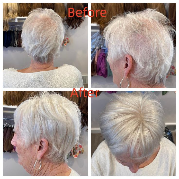 Summer Breathable&comfortable Short Hair Topper For Thinning Hair