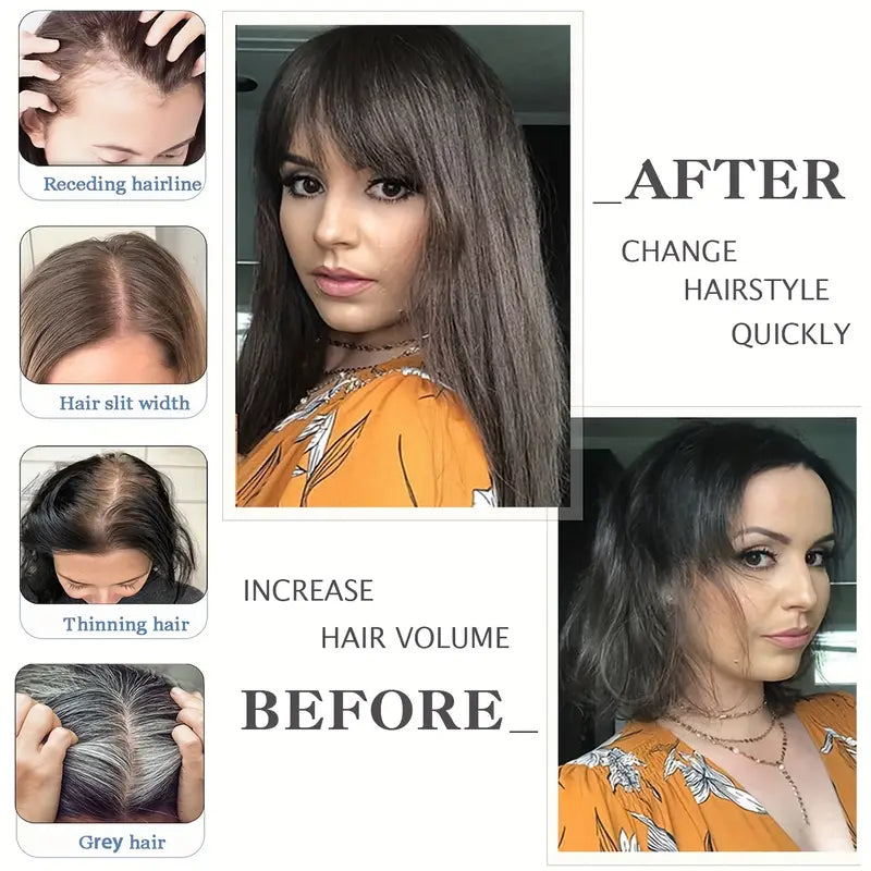 Comfortable & Breathable Clip-In Hair Topper – Designed for Thinning Hair - VIVACROWN