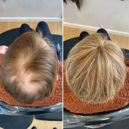 2025 Upgrade Version Short Wiglets Hair Pieces for Women with Thinning and Fine Hair