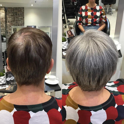 2025 New Summer Breathable Short Hair Topper for Thinning Hair