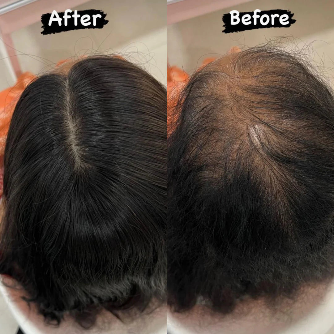 Breathable Straight Hair Topper-For Natural Coverage of Thinning Hair