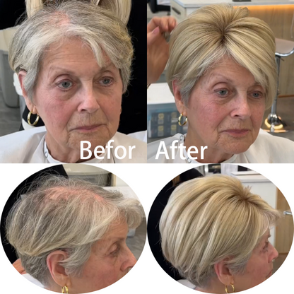 2025 Hot Sale Best Short Hair Toppers for Women with Thinning Hair