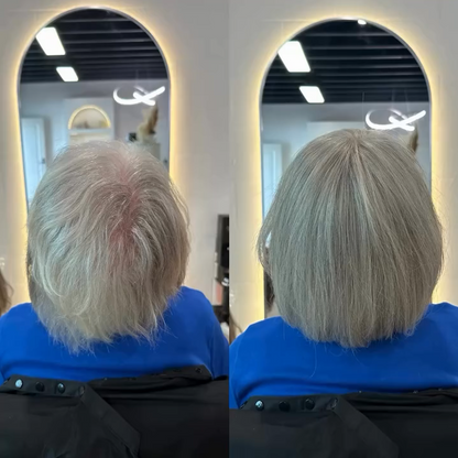 Breathable Straight Hair Topper-For Natural Coverage of Thinning Hair