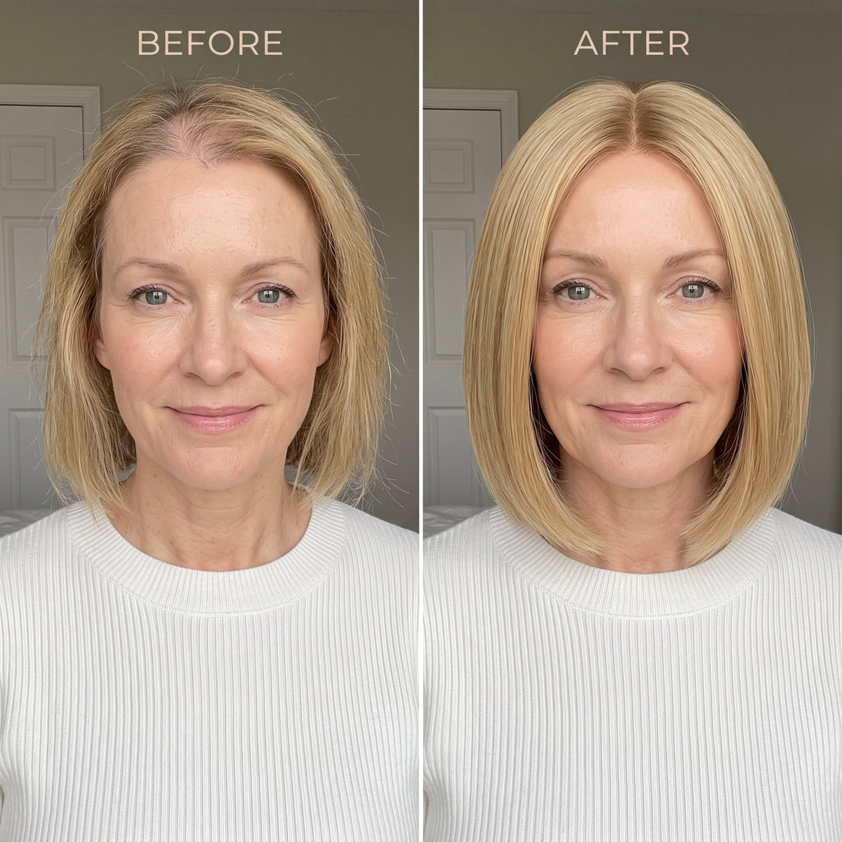 Instant Volume Hair Topper – Designed for Women with Thinning Hair