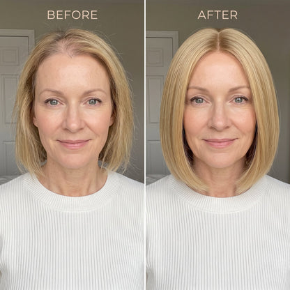 Instant Volume Hair Topper – Designed for Women with Thinning Hair