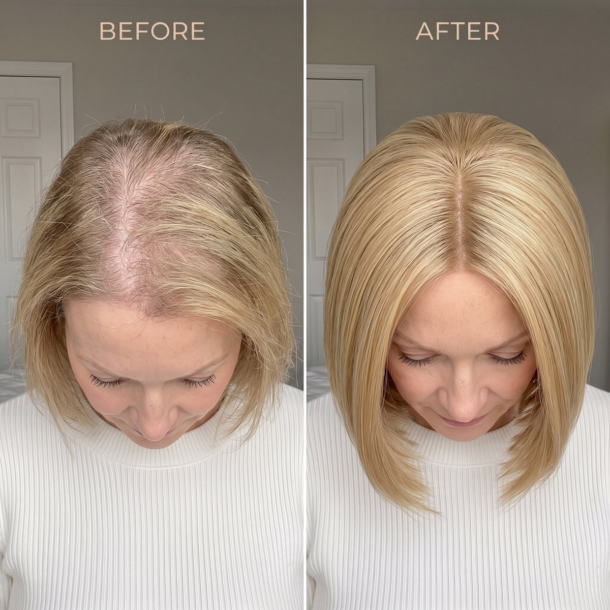 Instant Volume Hair Topper – Designed for Women with Thinning Hair