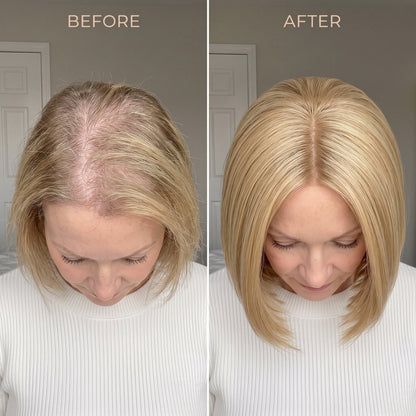 Instant Volume Hair Topper – Designed for Women with Thinning Hair