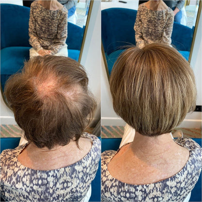Best-Selling Pixie Cut Hair Topper — Perfect for Thinning Hair!