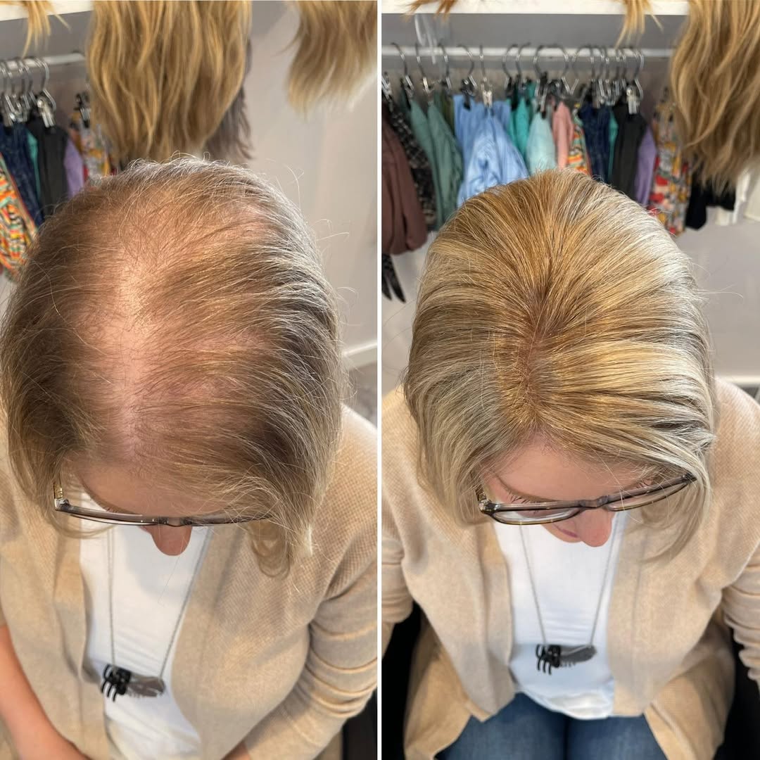 Straight Hair Topper for Crown Thinning – Natural Coverage at the Crown - VIVACROWN