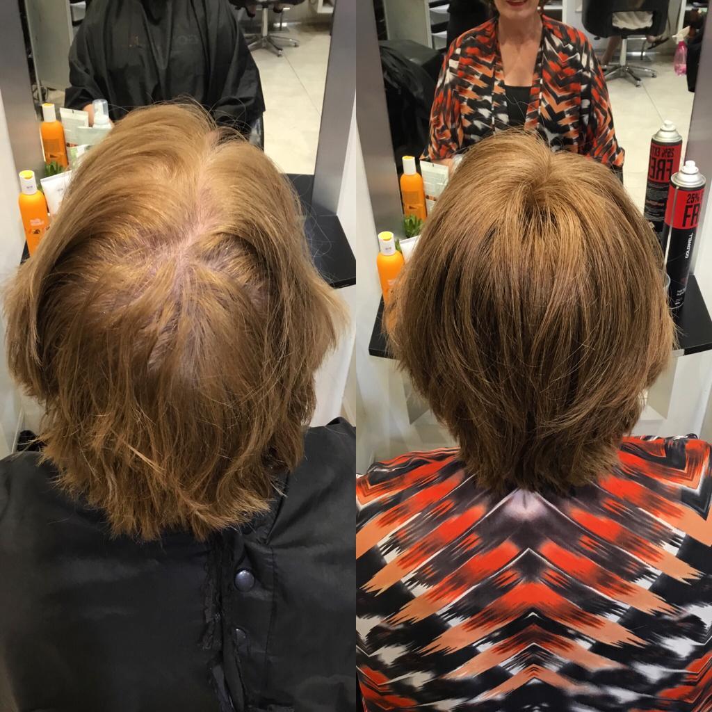 Summer Breathable Short Hair Topper for Thinning Hair