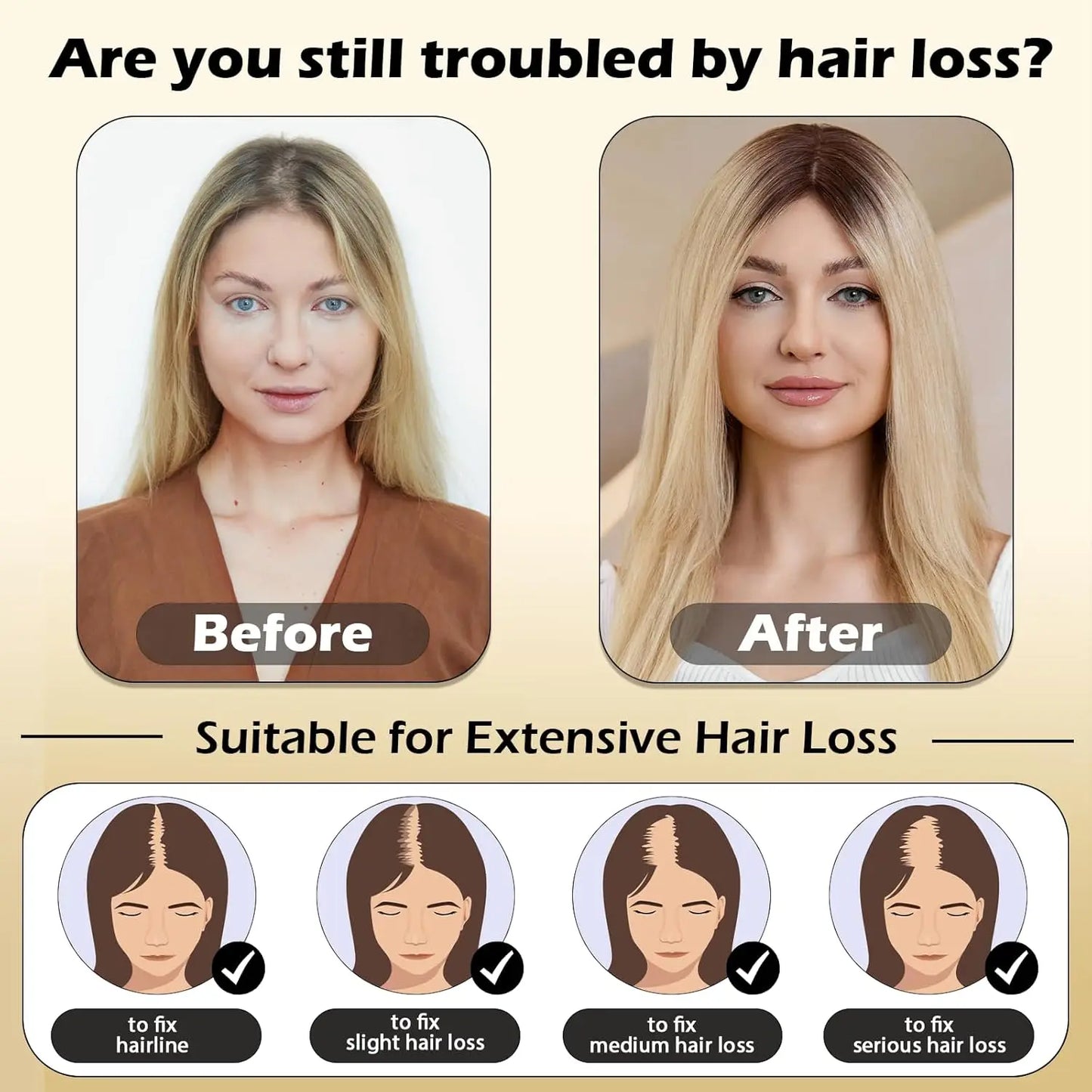 Hot Sale Straight Hair Topper For Women With Thinning Hair