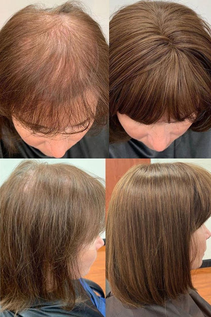 2025 New Straight Hair Topper With Bangs-Instant Volume in Seconds