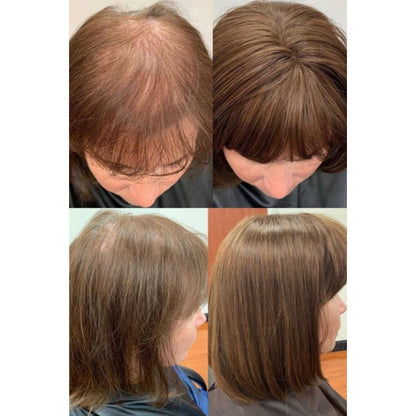 Premium Short Straight Hairpiece with Bangs - Instant Fullness & Breathable Comfort