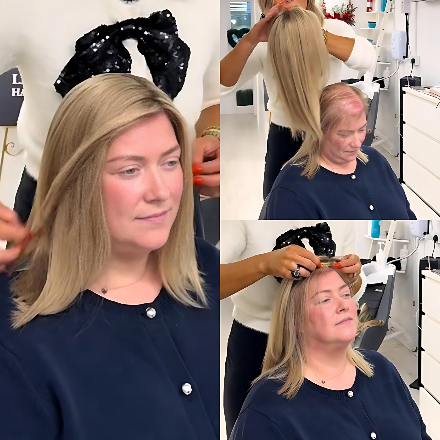 Summer Breathable Natural Straight Hair Topper For Women With Thinning Hair