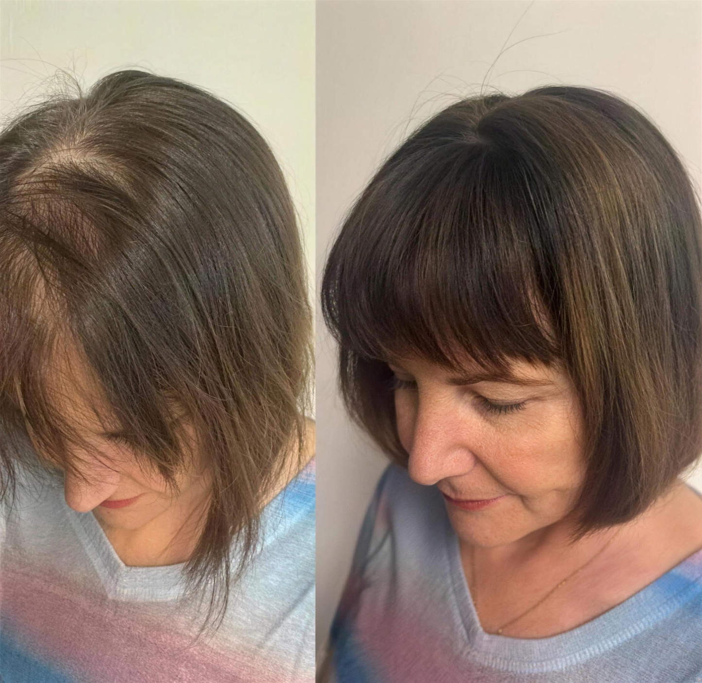 Lightweight & Breathable Clip-In Crown Topper — Natural Volume & Seamless Comfort